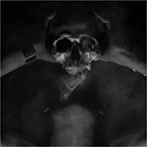 Balmog - Vacvvm