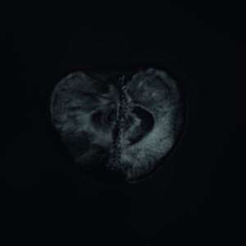 Sadon/treha Sektori - Symphomy Of Dying