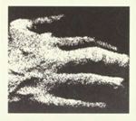 Tesa - C O N T R O L