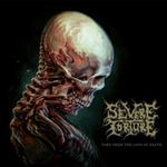 Severe Torture - Torn From The Jaws Of Death: Ltd Ed.