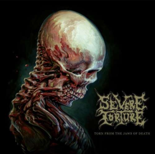 Severe Torture - Torn From The Jaws Of Death: Ltd Ed.